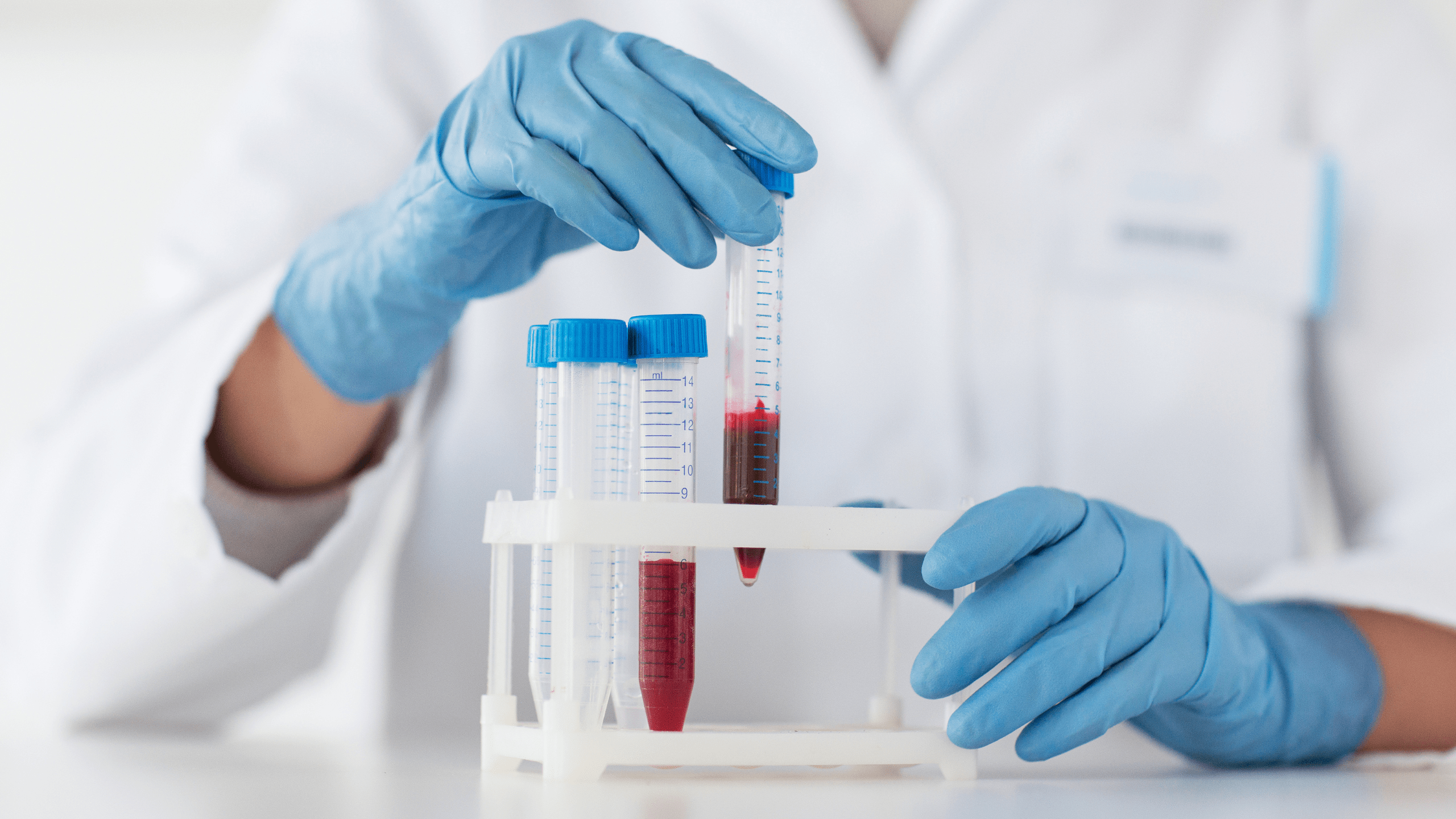 Diagnostic Lab Testing with 1st Optimal