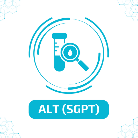 ALT (SGPT)