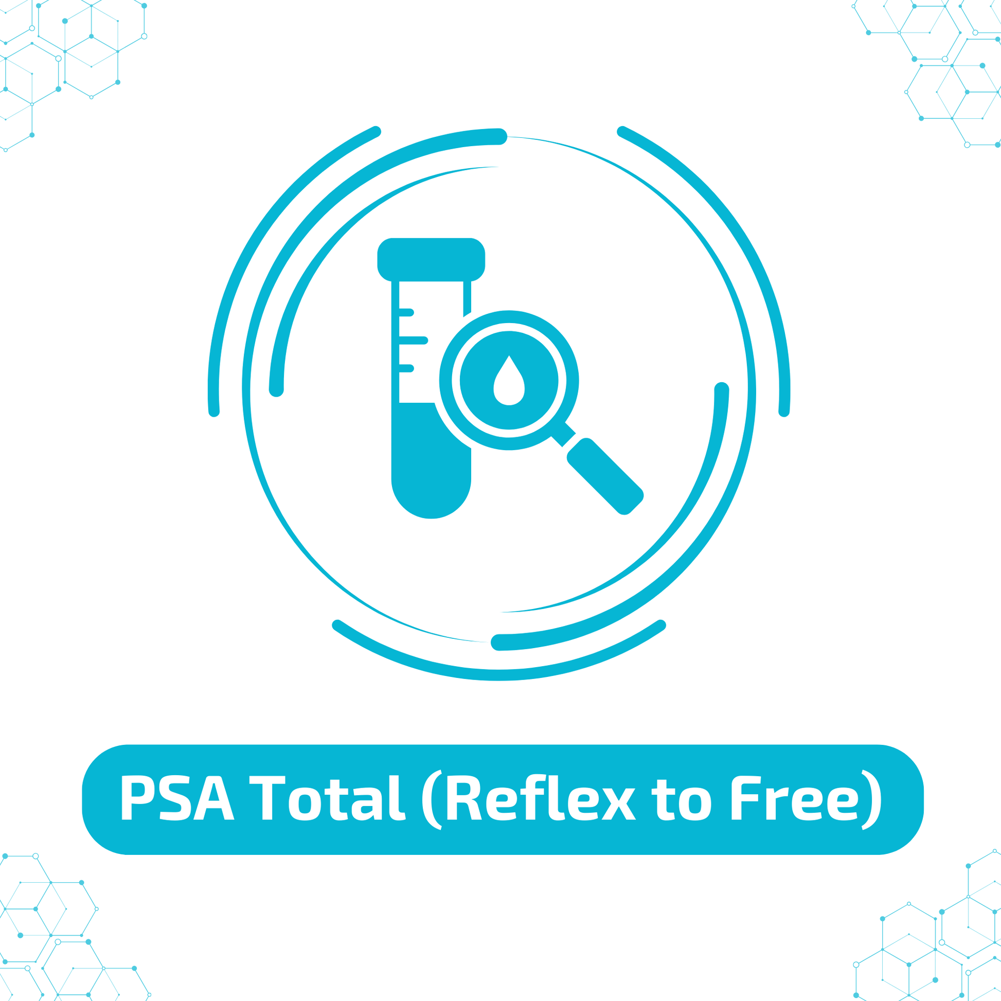 PSA Total (Reflex to Free)