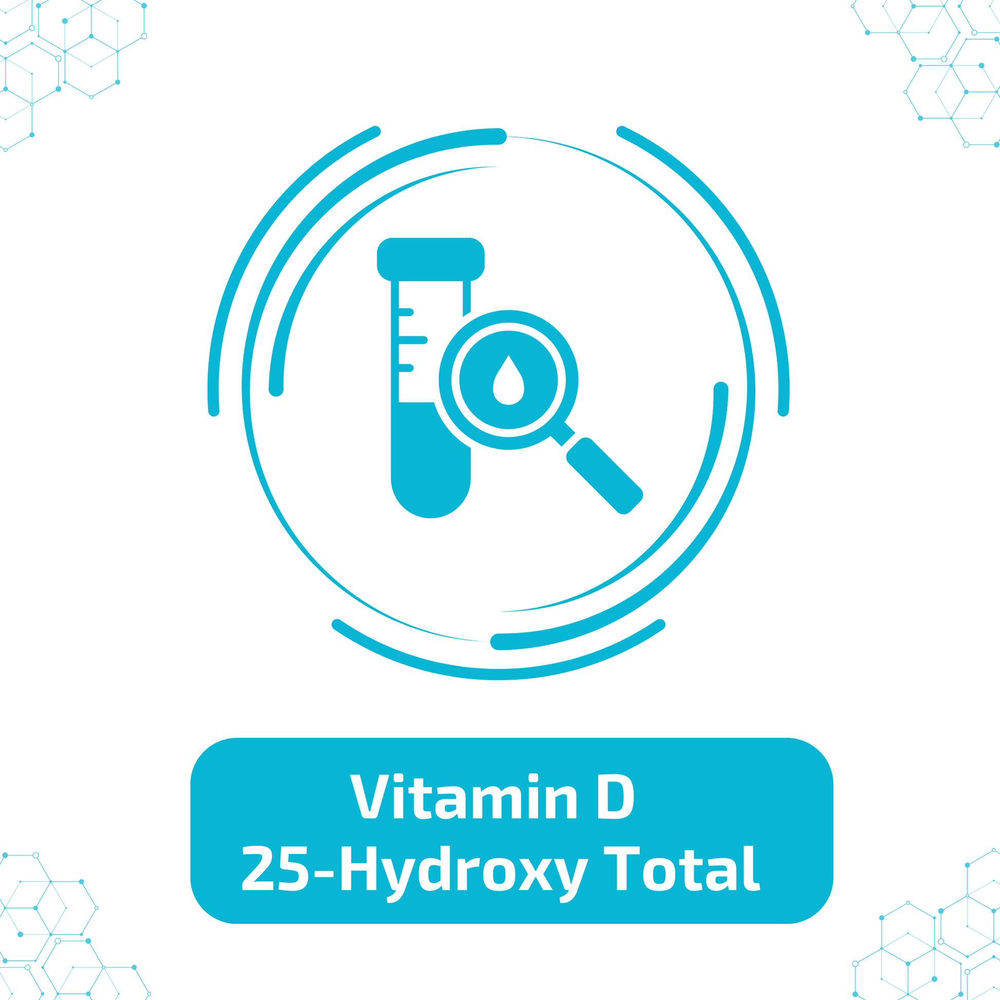 Vitamin D, 25-Hydroxy, Total